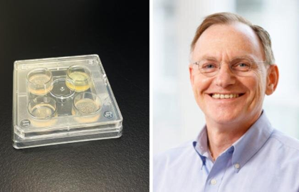 50 researchers reveal 5 steps to combat drug‑resistant fungi | 50 researchers reveal 5 steps to combat drug‑resistant fungi 50 researchers reveal 5 steps to combat drug‑resistant fungi | 50 researchers reveal 5 steps to combat drug‑resistant fungi