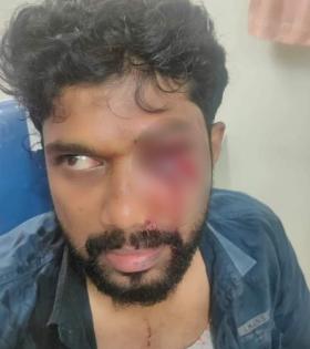 Congress alleges attack on LoP by CPI-M activists in Kerala | Congress alleges attack on LoP by CPI-M activists in Kerala