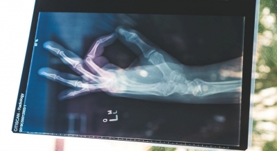 Bone trouble? | Bone trouble? Bone trouble? | Bone trouble?