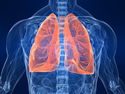 B’luru witnesses rising trend of lung cancer cases among women, non-smokers | B’luru witnesses rising trend of lung cancer cases among women, non-smokers B’luru witnesses rising trend of lung cancer cases among women, non-smokers | B’luru witnesses rising trend of lung cancer cases among women, non-smokers