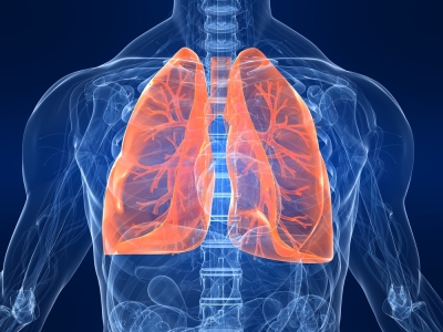 Study links colourless, odourless gas with the rise in lung cancers in non-smokers | Study links colourless, odourless gas with the rise in lung cancers in non-smokers Study links colourless, odourless gas with the rise in lung cancers in non-smokers | Study links colourless, odourless gas with the rise in lung cancers in non-smokers