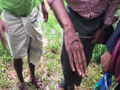 Farmers in Kerala's Kozhikode village troubled with leech infestation in paddy fields | Farmers in Kerala's Kozhikode village troubled with leech infestation in paddy fields