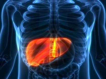 Hepatitis: Early detection a challenge with silent, vague symptoms, say doctors | Hepatitis: Early detection a challenge with silent, vague symptoms, say doctors Hepatitis: Early detection a challenge with silent, vague symptoms, say doctors | Hepatitis: Early detection a challenge with silent, vague symptoms, say doctors