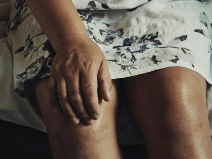 More than one in six arthritis patients are women, say doctors | More than one in six arthritis patients are women, say doctors More than one in six arthritis patients are women, say doctors | More than one in six arthritis patients are women, say doctors
