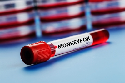 UK 'must take more action on monkeypox or it will become endemic' | UK 'must take more action on monkeypox or it will become endemic'