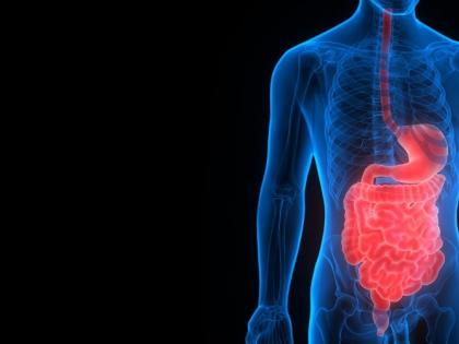 Urbanisation driving inflammatory bowel disease in young Indians: Lancet | Urbanisation driving inflammatory bowel disease in young Indians: Lancet Urbanisation driving inflammatory bowel disease in young Indians: Lancet | Urbanisation driving inflammatory bowel disease in young Indians: Lancet