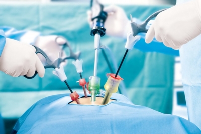 AI tool to help make real-time diagnoses during surgery: Study | AI tool to help make real-time diagnoses during surgery: Study AI tool to help make real-time diagnoses during surgery: Study | AI tool to help make real-time diagnoses during surgery: Study