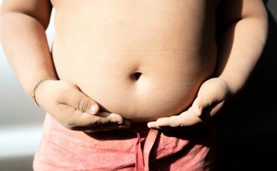 79% Americans think surgery for weight loss should be last resort: Study | 79% Americans think surgery for weight loss should be last resort: Study 79% Americans think surgery for weight loss should be last resort: Study | 79% Americans think surgery for weight loss should be last resort: Study