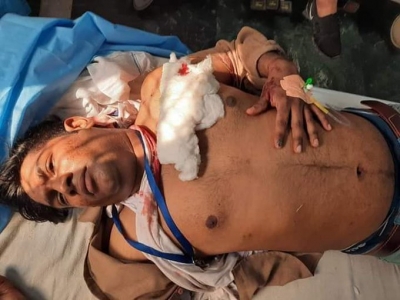 East Delhi clashes affect patients at GTB Hospital | East Delhi clashes affect patients at GTB Hospital East Delhi clashes affect patients at GTB Hospital | East Delhi clashes affect patients at GTB Hospital