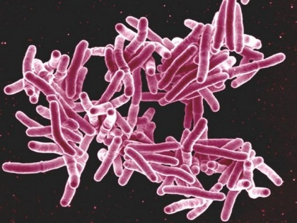 Researchers develop new cell-analysis technique to fight tuberculosis | Researchers develop new cell-analysis technique to fight tuberculosis