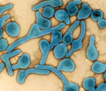 Tanzania declares end of second Marburg virus disease outbreak | Tanzania declares end of second Marburg virus disease outbreak Tanzania declares end of second Marburg virus disease outbreak | Tanzania declares end of second Marburg virus disease outbreak