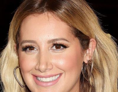 Ashley Tisdale suffers from alopecia | Ashley Tisdale suffers from alopecia Ashley Tisdale suffers from alopecia | Ashley Tisdale suffers from alopecia