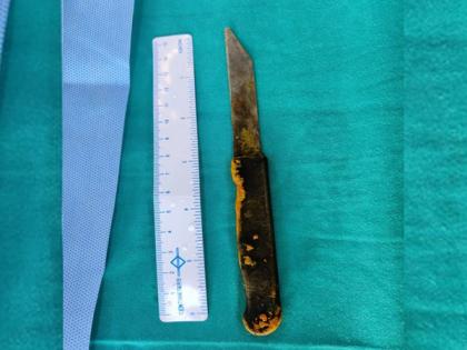 AIIMS doctors remove 20-cm long kitchen knife from man's abdomen | AIIMS doctors remove 20-cm long kitchen knife from man's abdomen