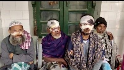 Jackal attacks farmers in Bihar's Katihar, 38 injured | Jackal attacks farmers in Bihar's Katihar, 38 injured