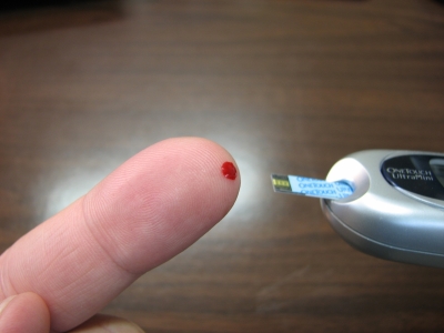 High blood sugar ups Covid-19 death risk: Study | High blood sugar ups Covid-19 death risk: Study High blood sugar ups Covid-19 death risk: Study | High blood sugar ups Covid-19 death risk: Study