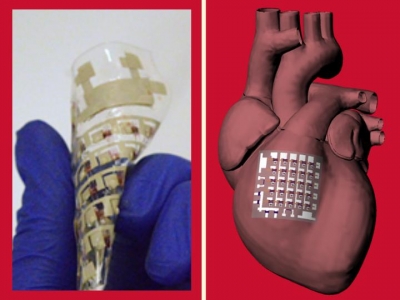 Novel rubbery cardiac patch can monitor, treat heart disease | Novel rubbery cardiac patch can monitor, treat heart disease Novel rubbery cardiac patch can monitor, treat heart disease | Novel rubbery cardiac patch can monitor, treat heart disease
