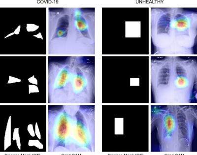 IIT Jodhpur team develops Covid diagnosis technique using chest X-Ray | IIT Jodhpur team develops Covid diagnosis technique using chest X-Ray IIT Jodhpur team develops Covid diagnosis technique using chest X-Ray | IIT Jodhpur team develops Covid diagnosis technique using chest X-Ray