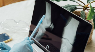 NIT Rourkela’s natural bioink to help 3D bioprinting of bone tissue | NIT Rourkela’s natural bioink to help 3D bioprinting of bone tissue NIT Rourkela’s natural bioink to help 3D bioprinting of bone tissue | NIT Rourkela’s natural bioink to help 3D bioprinting of bone tissue