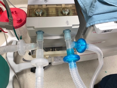B'luru hospital to test indigenous non-invasive ventilator | B'luru hospital to test indigenous non-invasive ventilator