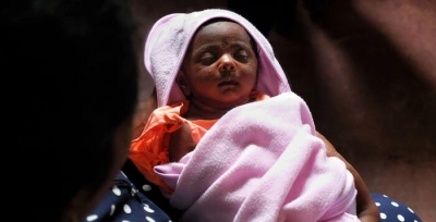 40,000 kids in SL may suffer from malnutrition in coming months: Minister | 40,000 kids in SL may suffer from malnutrition in coming months: Minister