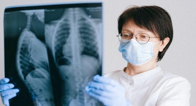 When Rheumatoid Arthritis affects your lungs | When Rheumatoid Arthritis affects your lungs