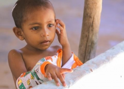 Malnutrition rises among Sri Lankan kids under 5: Health Minister | Malnutrition rises among Sri Lankan kids under 5: Health Minister
