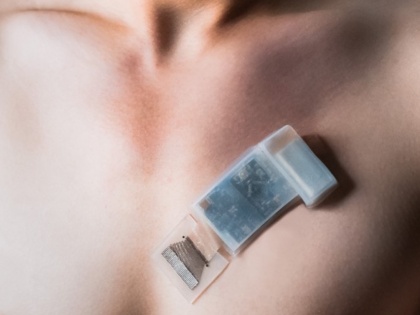 New wearable ultrasound system can monitor BP, heart function on the go | New wearable ultrasound system can monitor BP, heart function on the go