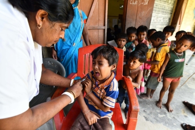 Measles Surge: Country on alert to manage post-pandemic crisis | Measles Surge: Country on alert to manage post-pandemic crisis