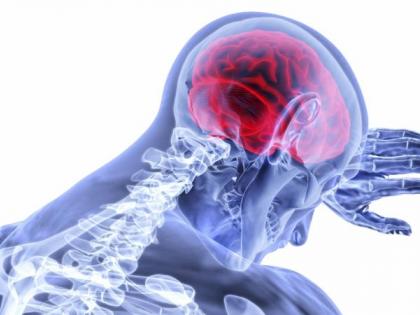 UK researchers develop new tool to reduce stroke risk | UK researchers develop new tool to reduce stroke risk UK researchers develop new tool to reduce stroke risk | UK researchers develop new tool to reduce stroke risk