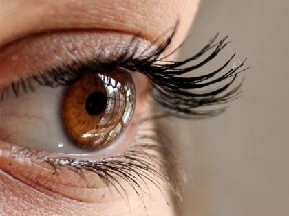 Conjunctivitis cases record sharp rise in two UP districts | Conjunctivitis cases record sharp rise in two UP districts Conjunctivitis cases record sharp rise in two UP districts | Conjunctivitis cases record sharp rise in two UP districts