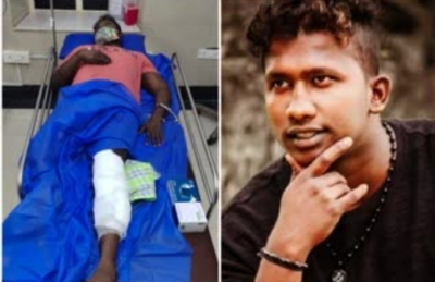 K'taka police shoots murder accused in leg as HE tries to escape | K'taka police shoots murder accused in leg as HE tries to escape
