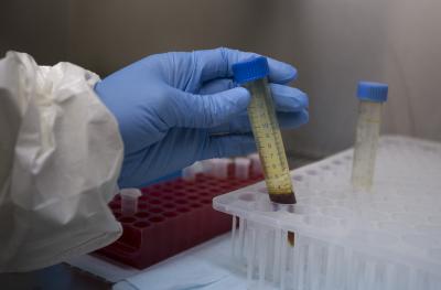 Novel test method detects Covid-19 virus in highly diluted gargle samples | Novel test method detects Covid-19 virus in highly diluted gargle samples