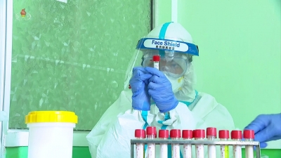 JN.1 Covid variant cases on the rise, experts advise not to panic | JN.1 Covid variant cases on the rise, experts advise not to panic JN.1 Covid variant cases on the rise, experts advise not to panic | JN.1 Covid variant cases on the rise, experts advise not to panic
