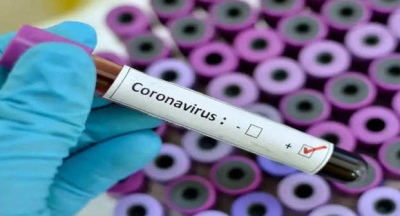 Coronavirus case tally among BSF men, kin in Tripura rises by one | Coronavirus case tally among BSF men, kin in Tripura rises by one