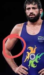 Repeatedly bitten by opponent, but wrestler Dahiya emerged on top | Repeatedly bitten by opponent, but wrestler Dahiya emerged on top