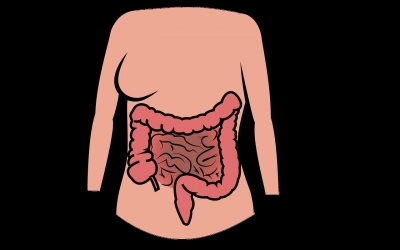 Late diagnosis of appendix cancer a concern, say experts | Late diagnosis of appendix cancer a concern, say experts Late diagnosis of appendix cancer a concern, say experts | Late diagnosis of appendix cancer a concern, say experts