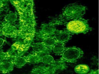 Scientists use common gene to profile microbial communities | Scientists use common gene to profile microbial communities