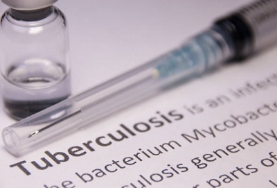 Tuberculosis remains key cause of ill health, death in South Africa | Tuberculosis remains key cause of ill health, death in South Africa
