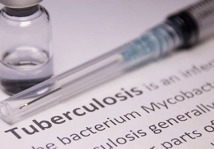 New, shorter drug-resistant tuberculosis treatment shows promise | New, shorter drug-resistant tuberculosis treatment shows promise