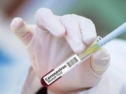 Drug peddler accused Rohan Talwar tests positive for COVID-19 | Drug peddler accused Rohan Talwar tests positive for COVID-19