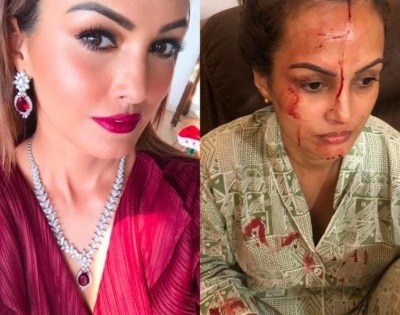 Nisha Rawal accuses Karan Mehra of having an affair, beating her | Nisha Rawal accuses Karan Mehra of having an affair, beating her