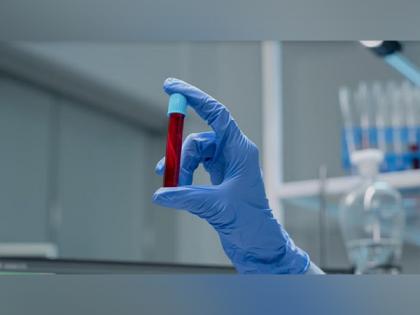 Kindly launches first Indian lab tests with At-home Collection for Erectile Dysfunction and Pre-mature Ejaculation | Kindly launches first Indian lab tests with At-home Collection for Erectile Dysfunction and Pre-mature Ejaculation Kindly launches first Indian lab tests with At-home Collection for Erectile Dysfunction and Pre-mature Ejaculation | Kindly launches first Indian lab tests with At-home Collection for Erectile Dysfunction and Pre-mature Ejaculation
