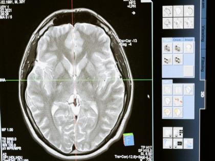 Distinct brain networks related to risk and resilience in depression identified during study | Distinct brain networks related to risk and resilience in depression identified during study