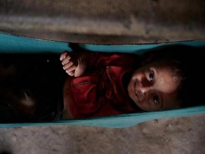 Over 1 in 9 children in flood-affected areas of Pakistan suffering from severe acute malnutrition: UNICEF | Over 1 in 9 children in flood-affected areas of Pakistan suffering from severe acute malnutrition: UNICEF