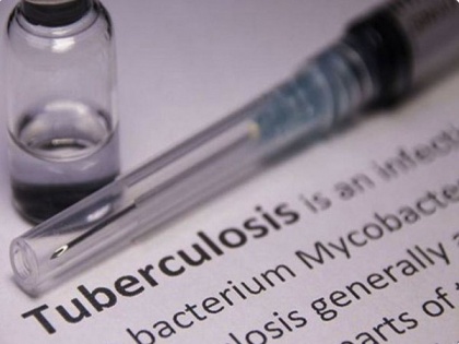 Tuberculosis cases surged for the first time in many years: WHO | Tuberculosis cases surged for the first time in many years: WHO
