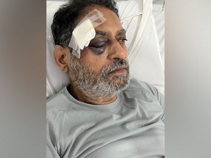 Congress leader Nitin Raut injured during Bharat Jodo Yatra in Telangana | Congress leader Nitin Raut injured during Bharat Jodo Yatra in Telangana
