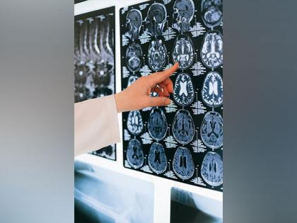 Researchers find new model of how brain functions | Researchers find new model of how brain functions Researchers find new model of how brain functions | Researchers find new model of how brain functions