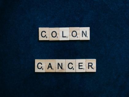 Researchers find cells that cause relapse of colon cancer | Researchers find cells that cause relapse of colon cancer