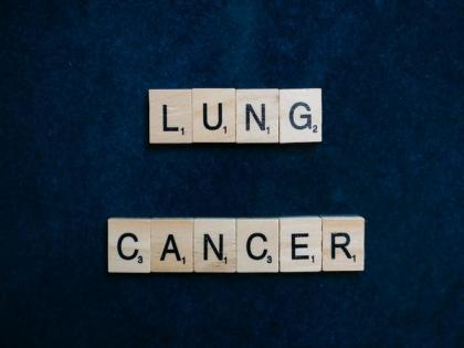 Alarming rise in lung cancer amongst non-smokers, women and youngsters - Study | Alarming rise in lung cancer amongst non-smokers, women and youngsters - Study Alarming rise in lung cancer amongst non-smokers, women and youngsters - Study | Alarming rise in lung cancer amongst non-smokers, women and youngsters - Study