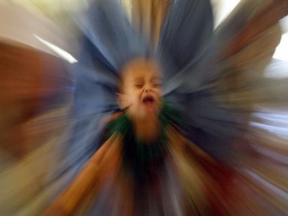 Measles becomes 'an imminent global threat' due to the Covid pandemic: WHO | Measles becomes 'an imminent global threat' due to the Covid pandemic: WHO Measles becomes 'an imminent global threat' due to the Covid pandemic: WHO | Measles becomes 'an imminent global threat' due to the Covid pandemic: WHO